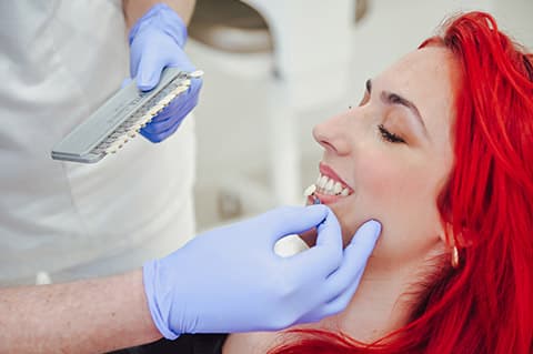 Faccette dentali